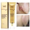 SCAR & STRECH MARK REMOVER OINTMENT