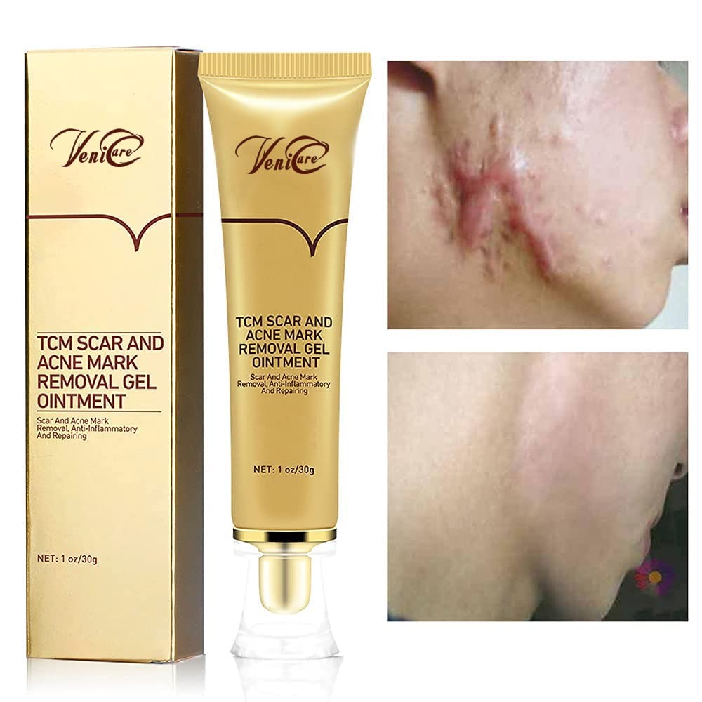 SCAR & STRECH MARK REMOVER OINTMENT